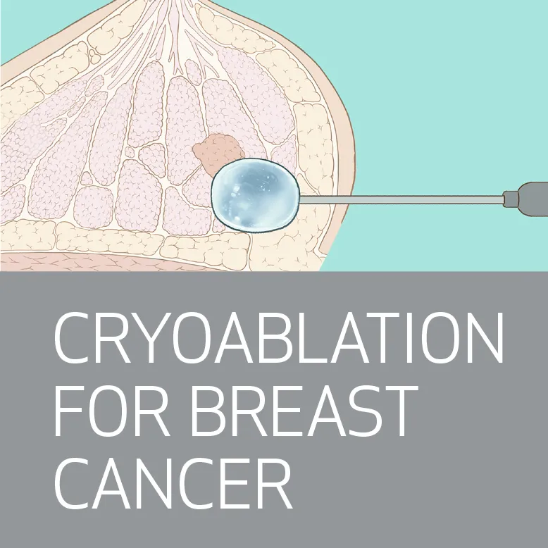 Cryoablation