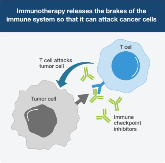 Immunotherapy