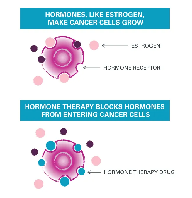 Hormone Therapy